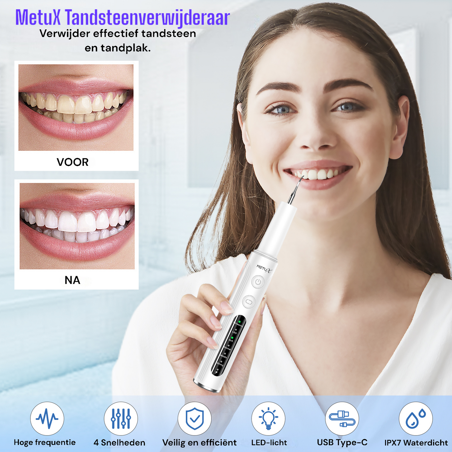 MetuX® Elektrische Tandsteenverwijderaar - Tandplak Verwijderaar