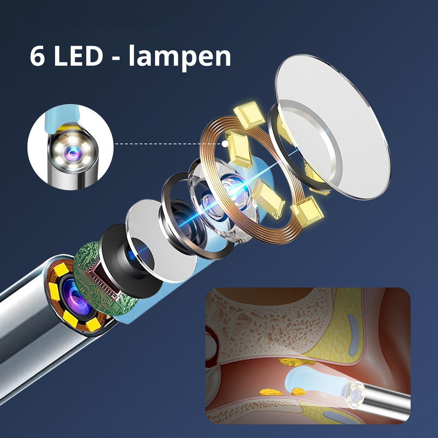 MetuX® Oorsmeerverwijderaar met Camera Zwart - Ultra HD Camera
