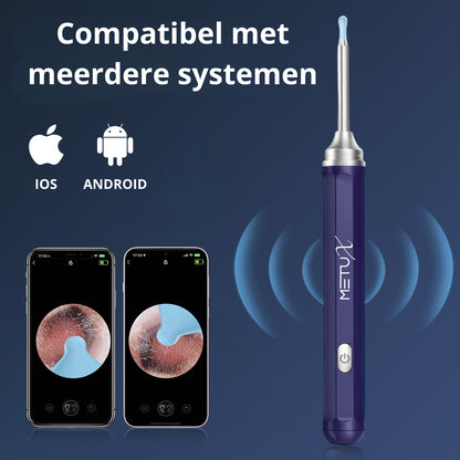 MetuX® Oorsmeerverwijderaar met Camera Blauw- Ultra HD Camera