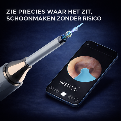 MetuX® Oorsmeerverwijderaar met Camera Wit - Ultra HD Camera