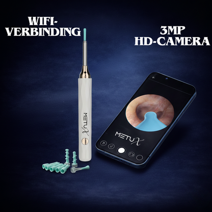 MetuX® Oorsmeerverwijderaar met Camera Wit - Ultra HD Camera