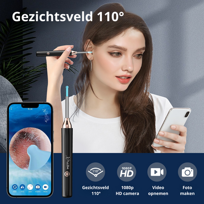 MetuX® Oorsmeerverwijderaar met Camera Zwart - Ultra HD Camera
