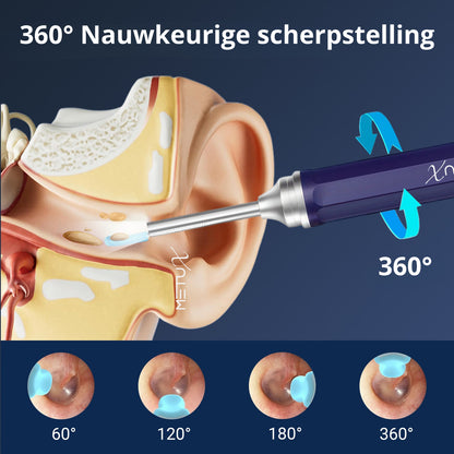 MetuX® Oorsmeerverwijderaar met Camera Blauw- Ultra HD Camera