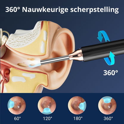 MetuX® Oorsmeerverwijderaar met Camera Zwart - Ultra HD Camera