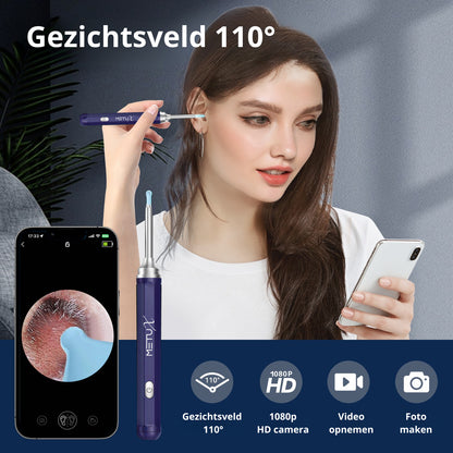 MetuX® Oorsmeerverwijderaar met Camera Blauw- Ultra HD Camera